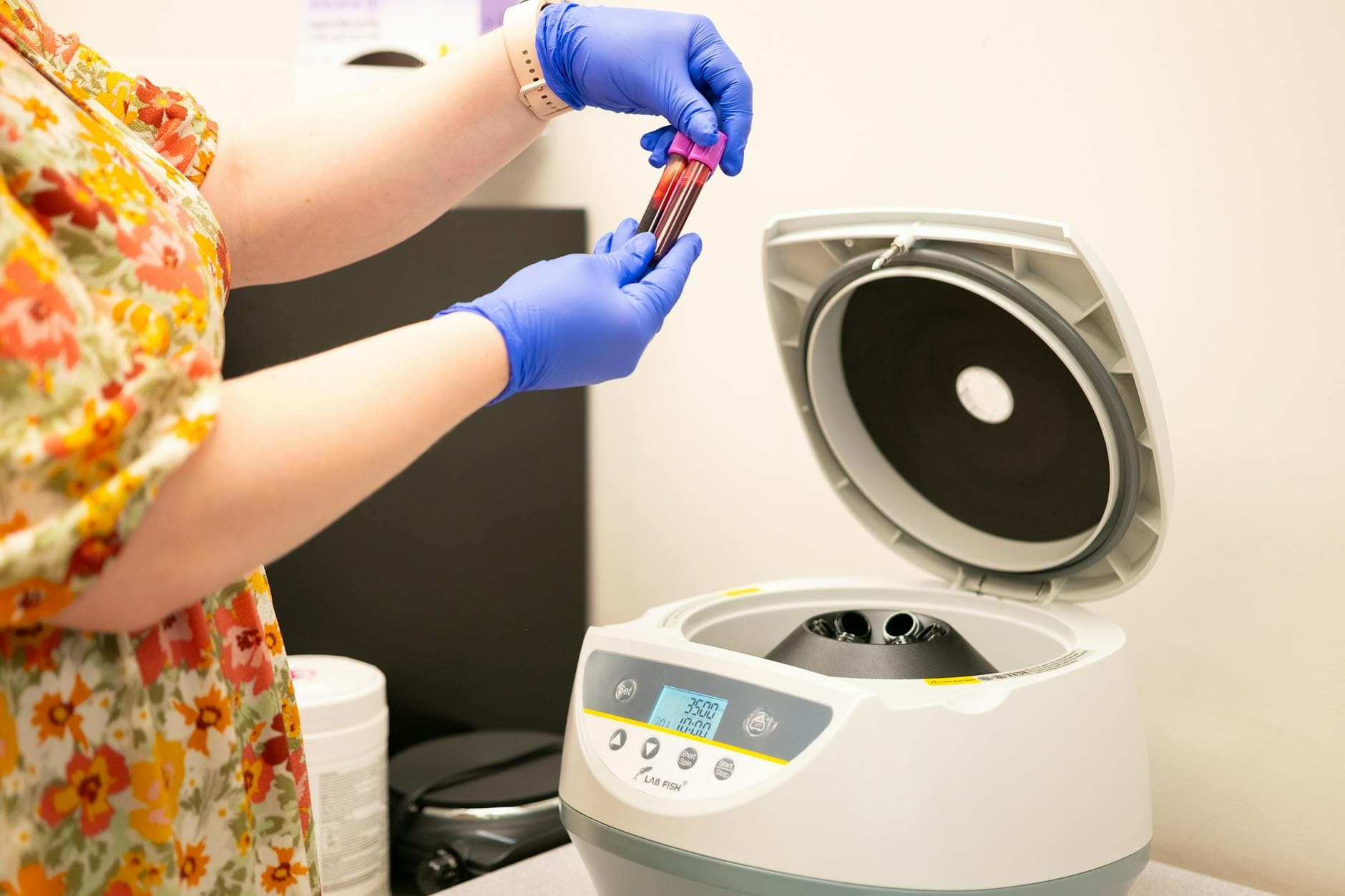Platelet-Rich Plasma (PRP)